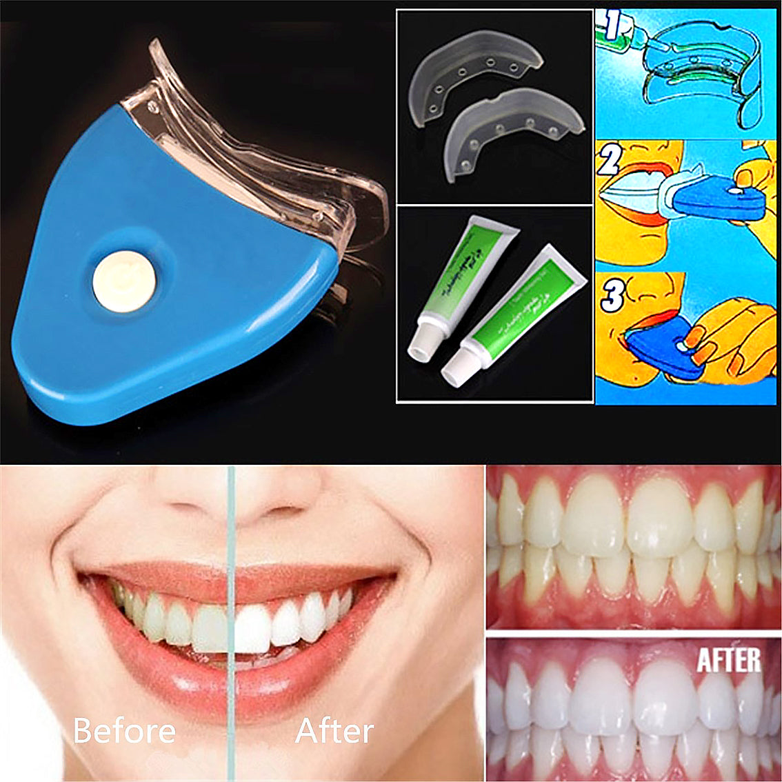 Gel Oral Dientes Blanqueamiento Dental Blanqueador Blanqueamiento Dental LED